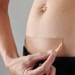 myscar The Original Caesarean Silicone Strips